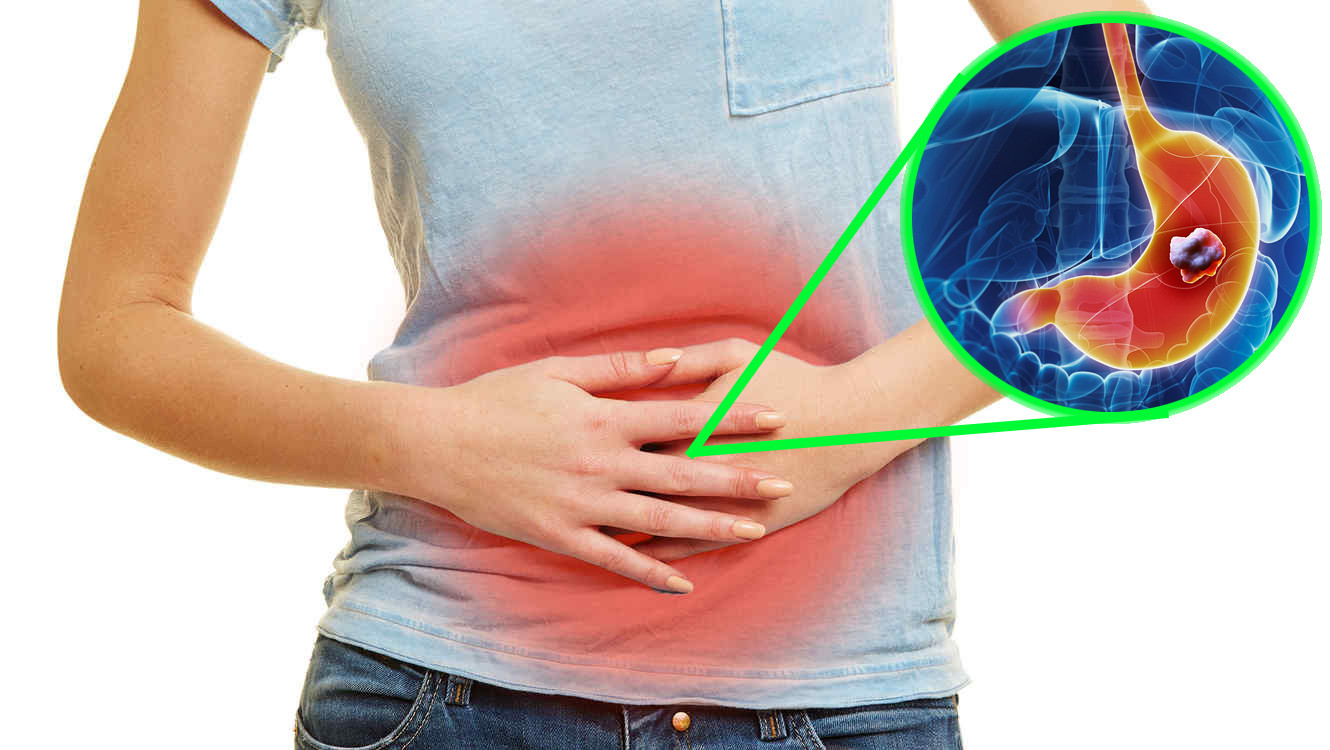 Se cura la gastritis atrófica