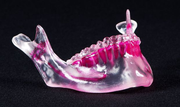 Un nino chino recibe el primer implante de mandibula creada en impresora 3d 4377 620x368