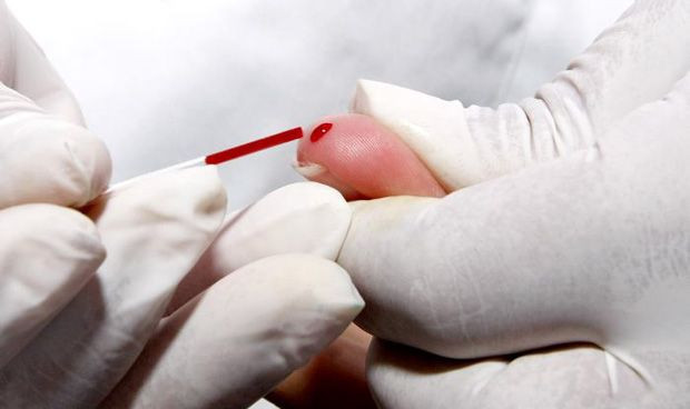 Carcel para un medico que infecto de vih a 5 mujeres 2 estaban embarazadas 9164 620x368
