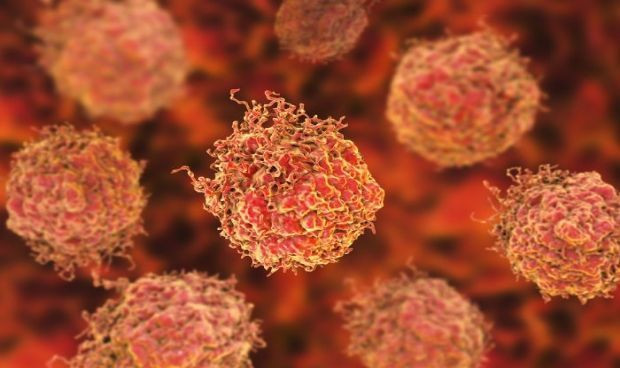 El nuevo marcador genetico que podria detectar cancer de prostata agresivo 4455 620x368