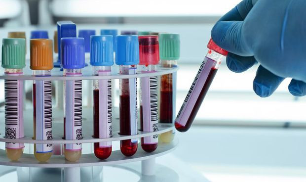 Un nuevo analisis de sangre detecta ocho tipos de cancer 4064 620x368