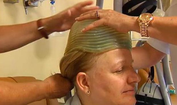 Un casco logra evitar que caiga el pelo por la quimioterapia 9446 620x368