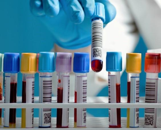 Analisis sangre1