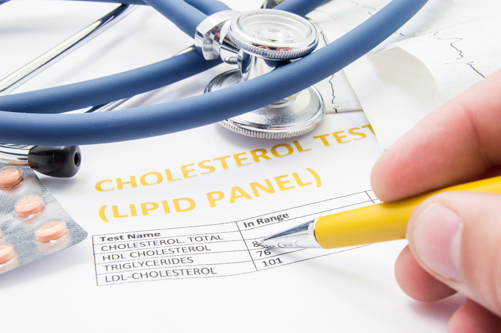 Cholesterol level lipid panel
