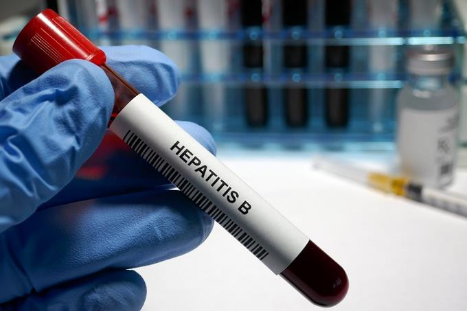 Cinco cosas que debes saber sobre la hepatitis