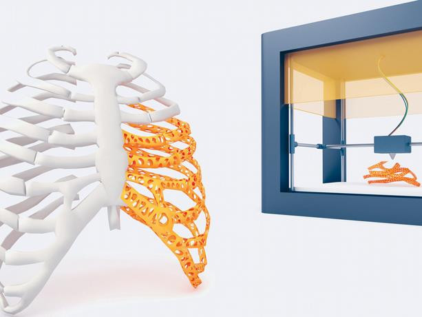 La bioimpresion 3d en la medicina personalizada