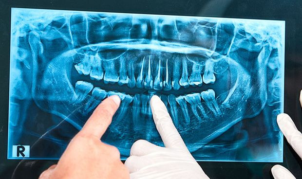 Multa de 2 5 millones por implantar una protesis a una mujer alergica 6511 620x368