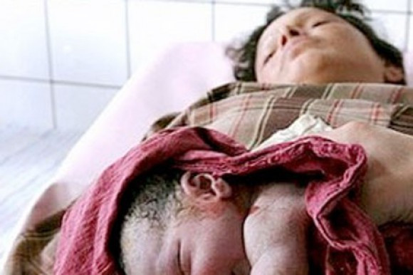 Mortalidad materna en Rep. Dominicana. Redes