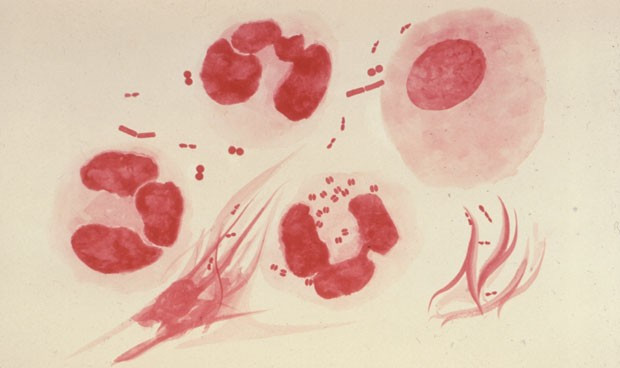 Reino unido investiga 4 casos de gonorrea resistente con origen en ibiza 4624 620x368