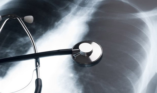 un dispositivo hace trasplantables pulmones que hasta ahora se desechaba 1781 620x368