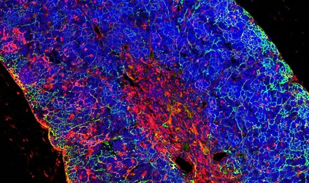 Investigadores espanoles descubren la predisposicion genetica a la leucemia 6113 620x368