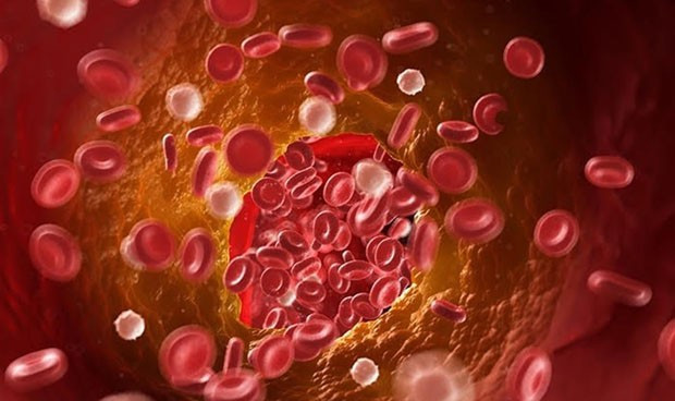 Celulas mutantes se unen para producir un cancer de sangre mas mortal 9852 620x368