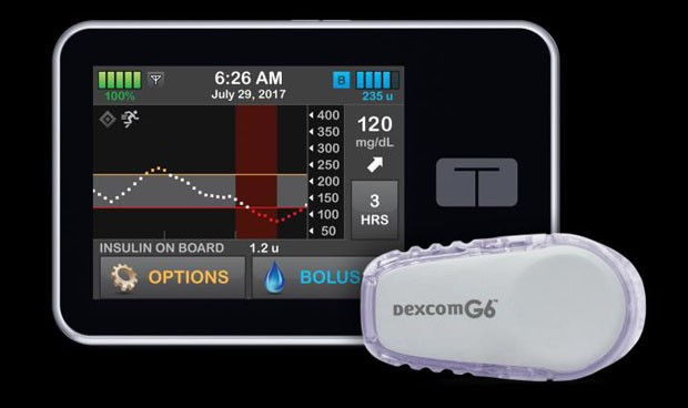 El pancreas artificial mejora los controles de glucosa de dia y de noche 5313 620x368