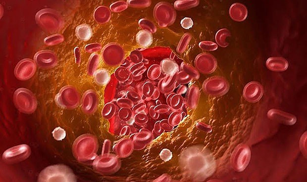 La terapia genica ofrece beneficios a largo plazo en hemofilia a 9391 620x368