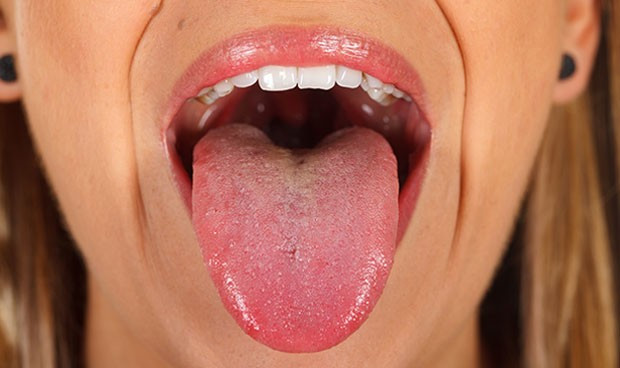 Perder grasa en la lengua mejora la apnea obstructiva del sueno 3965 620x368