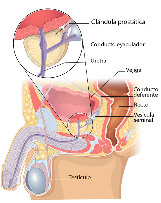 Prostate basic lg sp