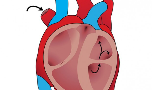 Colchicina medicamento para la gota reduce el riesgo cardiovascular 6345 620x368
