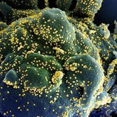 Se reportan otras 16 muertes por coronavirus rd se acerca a dos mil defunciones