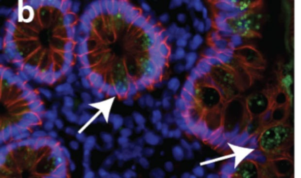 Covid 19 posible infeccion latente o cronica en ciertos casos 5554 620x368