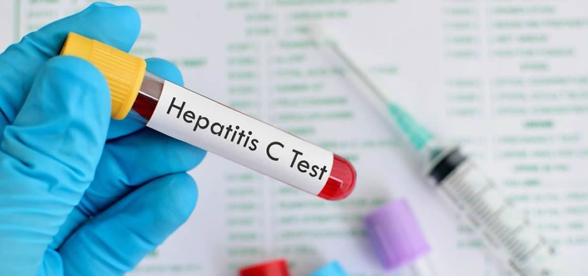 Hepatitis c test