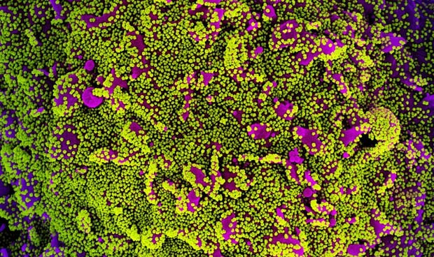 Uitima hora coronavirus espana hoy efectos de las vacunas y datos covid 620x368