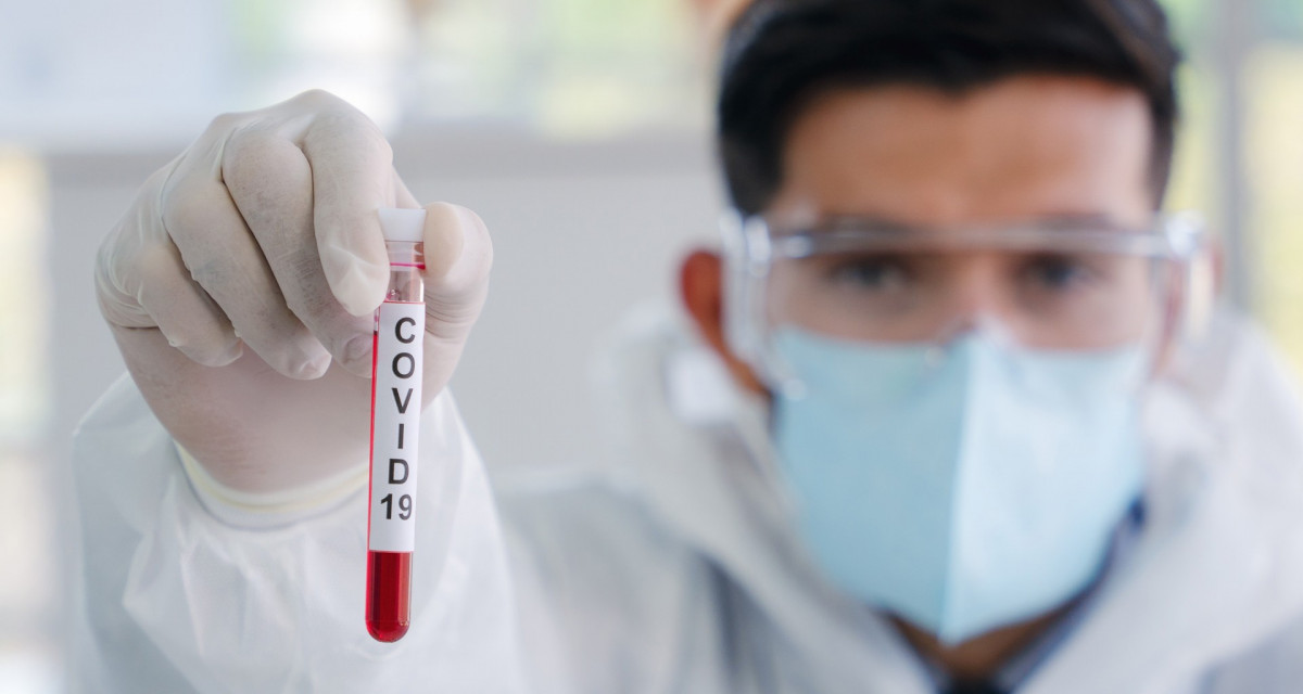 Covid 19 dudas infectologo tec salud 0