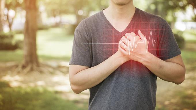 Calcio en una arteria fuera del corazon podria predecir un futuro infarto