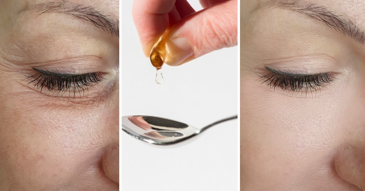Como usar la vitamina e para rejuvenecer el contorno de ojos