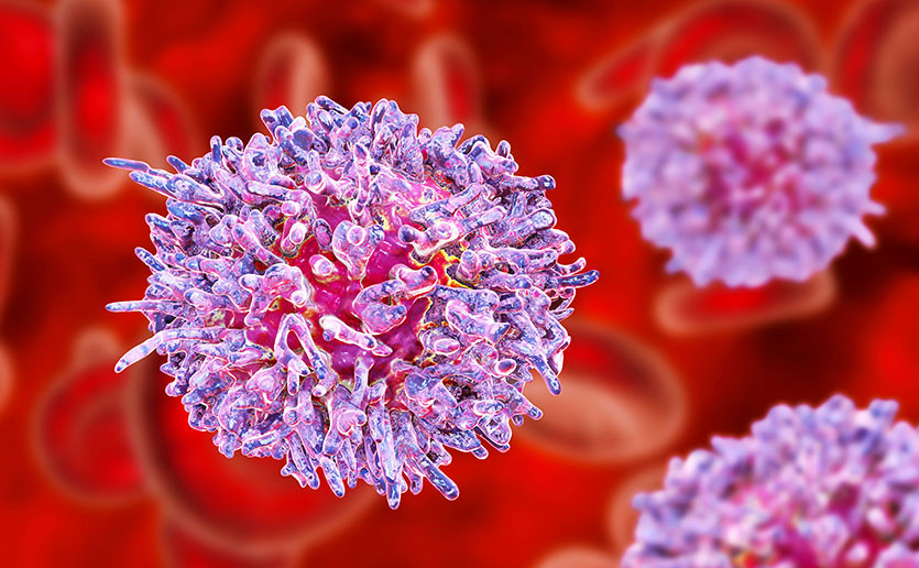Leukemia