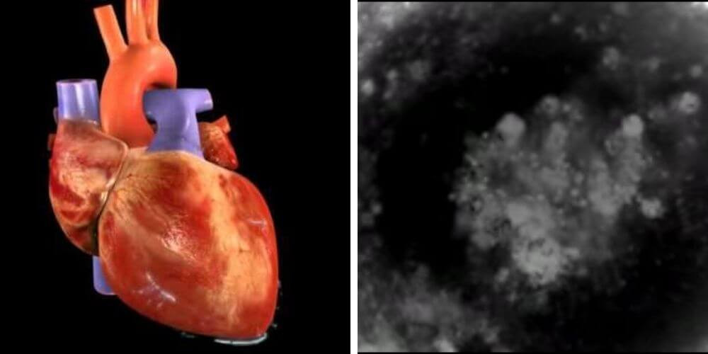 Cientificos crean los primeros mini corazones humanos a partir celulas madre