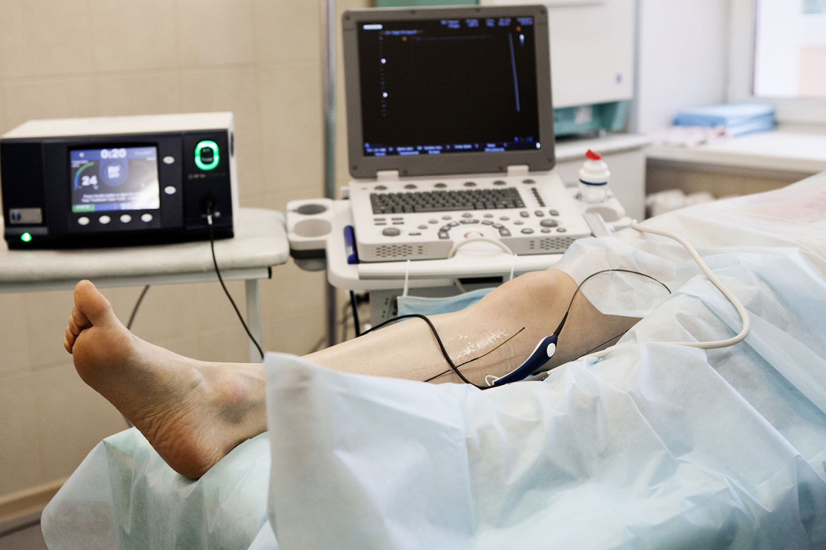 Blog phlebologist feat