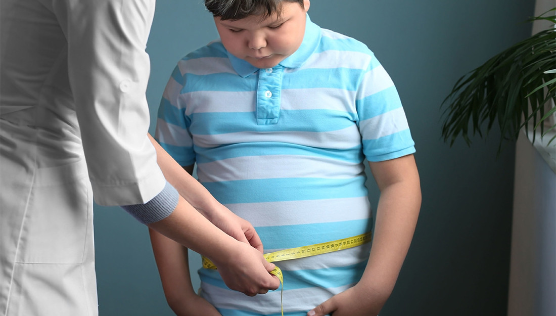 Obesity feature