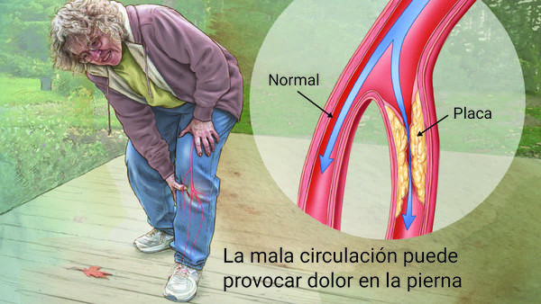 Descarga