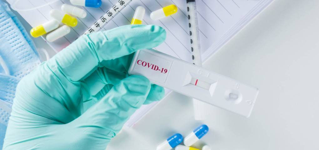 Asi funcionan los test rapidos para la COVID 19
