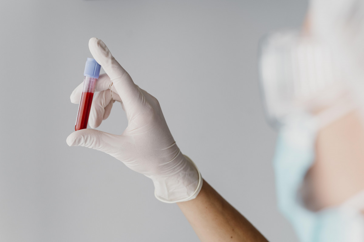 Medico vista posterior sosteniendo muestra sangre