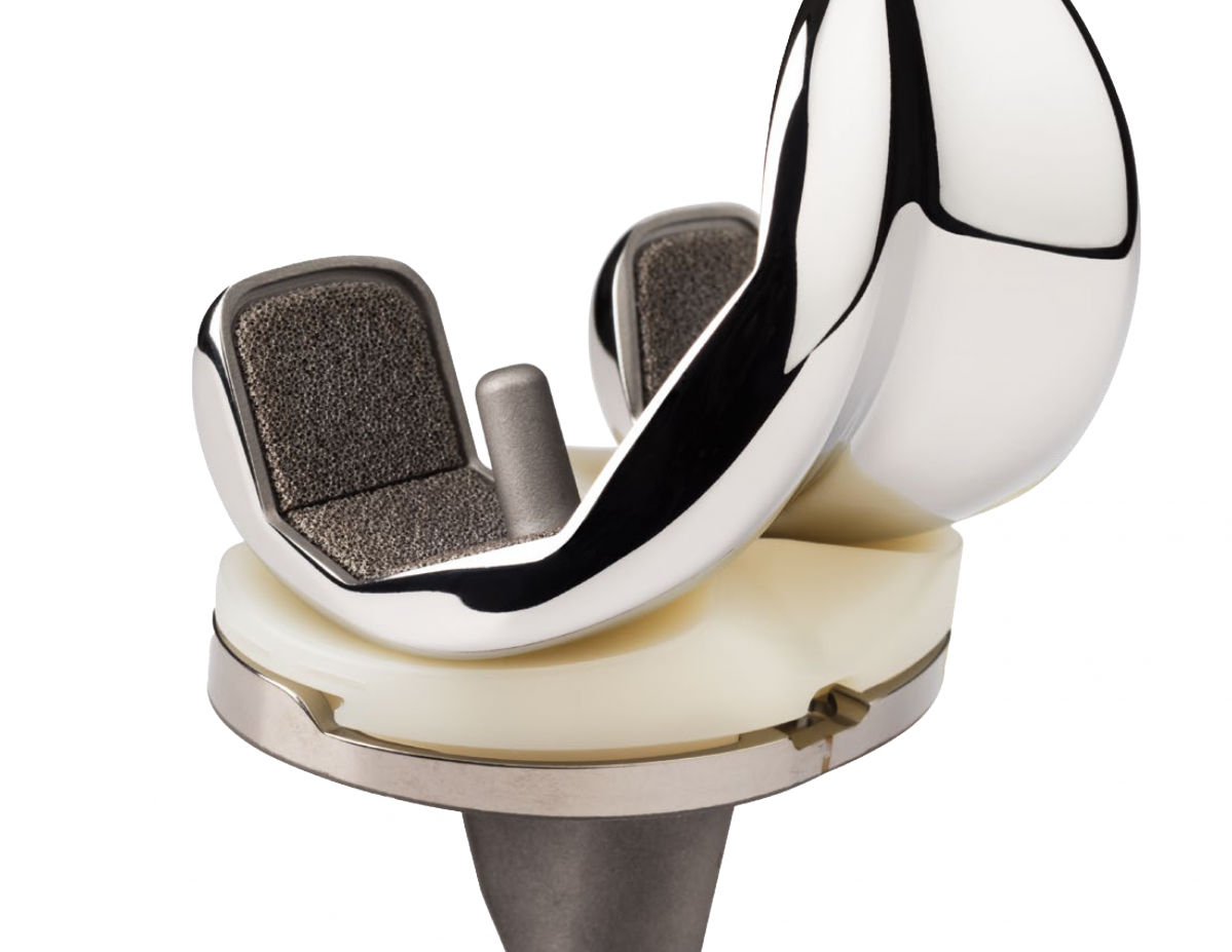 Pru00f3tesis de rodilla