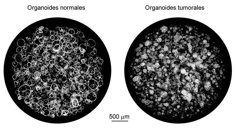Organoides