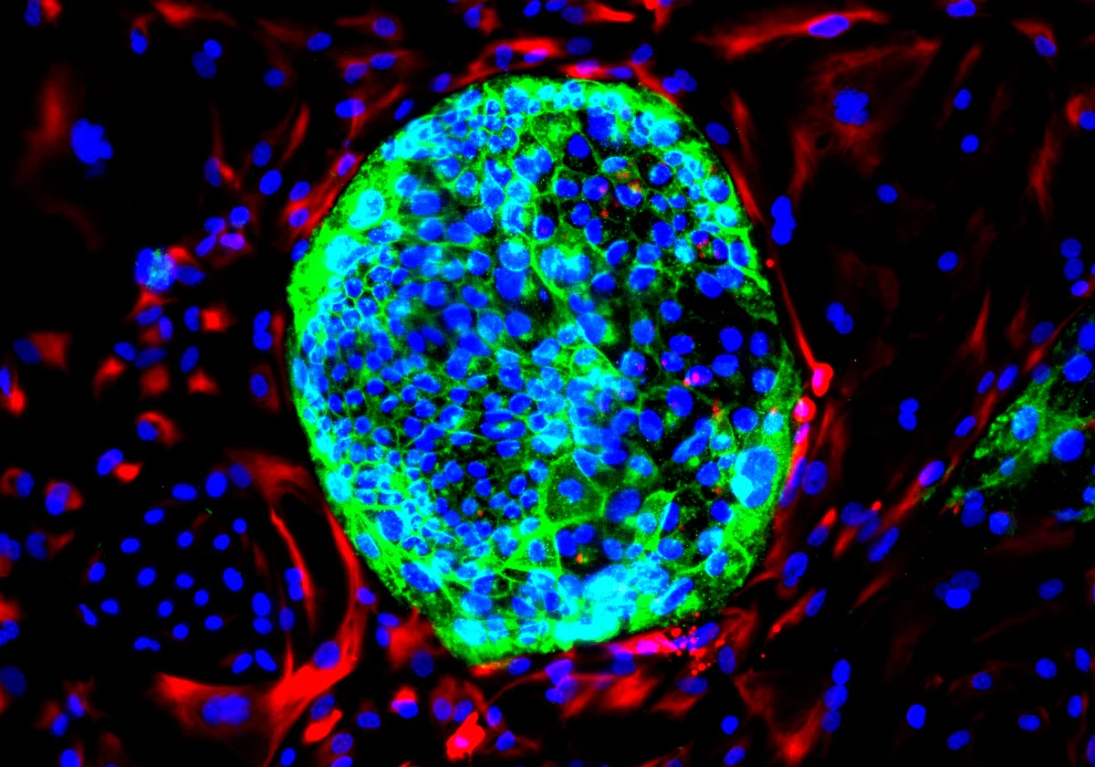 Celula cancer