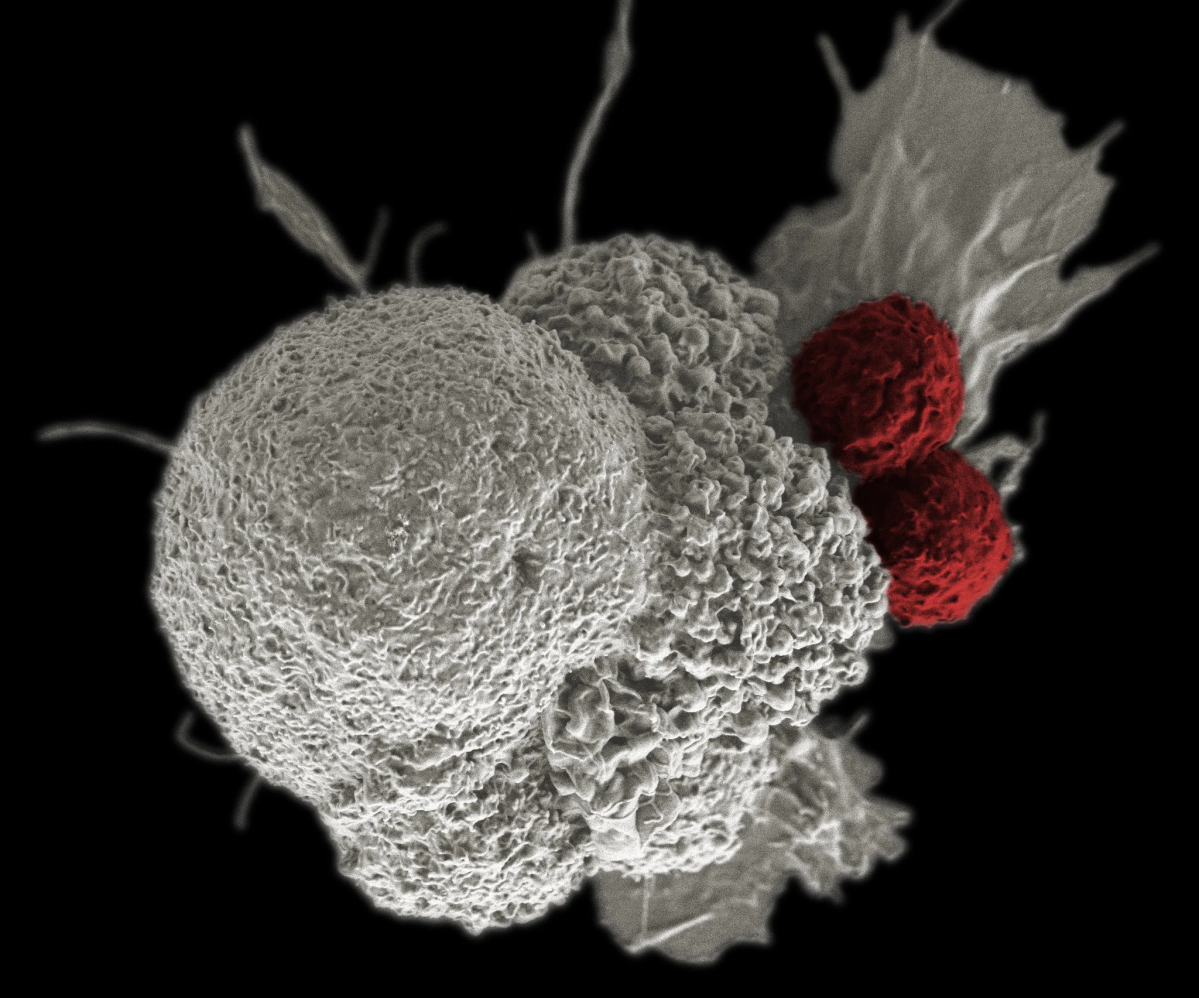 Cell cancer