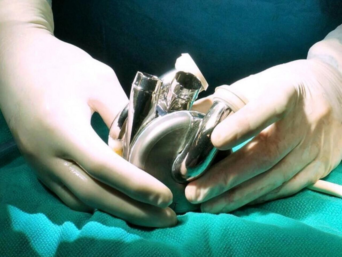 BiVACORu00ae Total Artificial Heart Surgery Credit BiVACOR