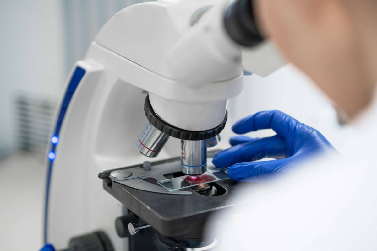 La falta de una proteina inicia el cancer de colon en ratones