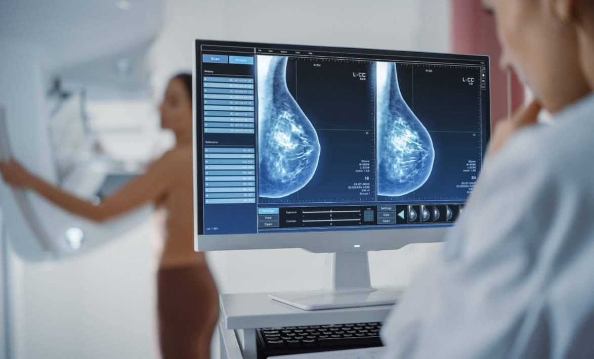 Los virus respiratorios despiertan celulas metastasicas de cancer de mama en los pulmones